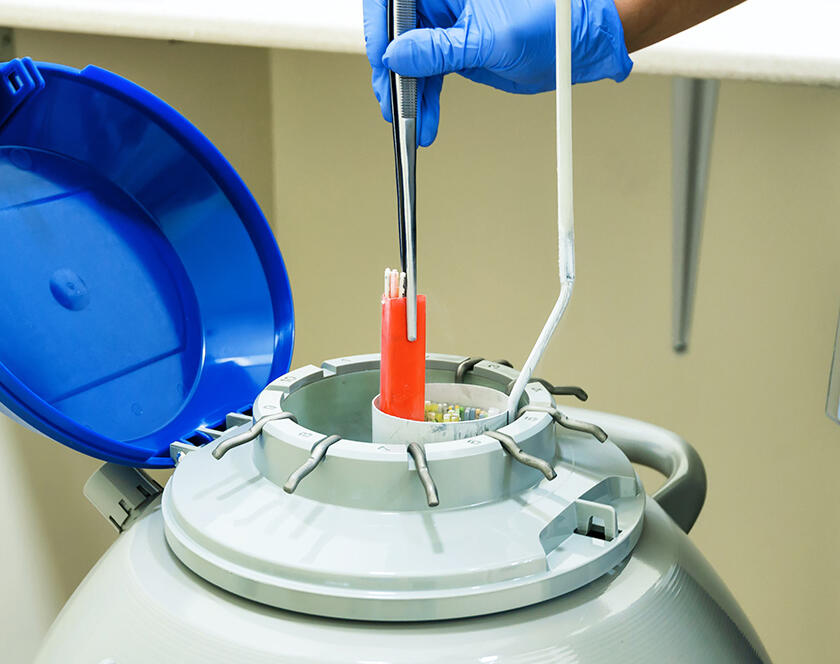 Egg Freezing Center in Chennai