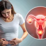 PCOS Is Not Just About Periods: The Hidden Impacts on Mind and Metabolism